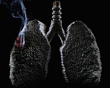 Lung Cancer Quit Smoking