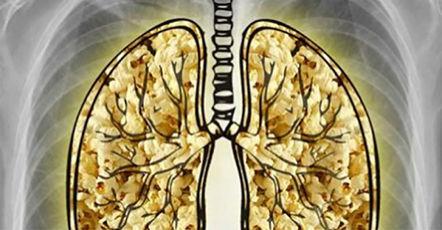 E-Cigs Diacetyl Popcorn Lung