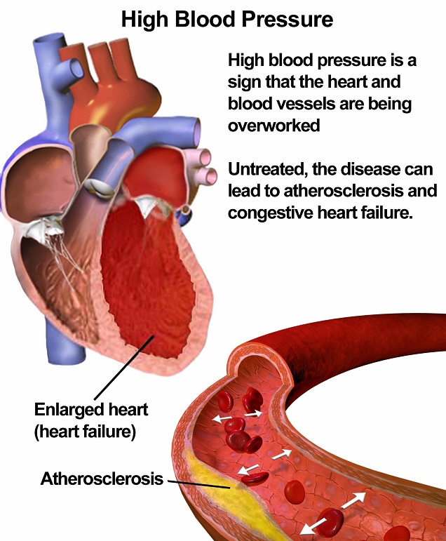 nicotine causes high blood pressure in smokers